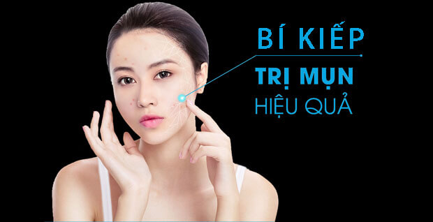 6 nguyên nhân gây mụn và các sản phẩm hỗ trợ điều trị